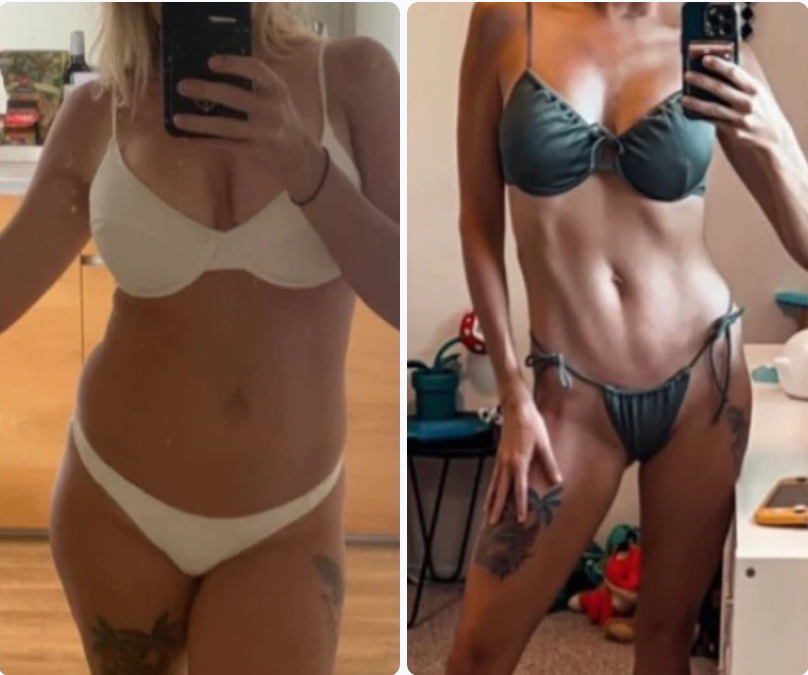 Jessica R. - Before and After Clarexin